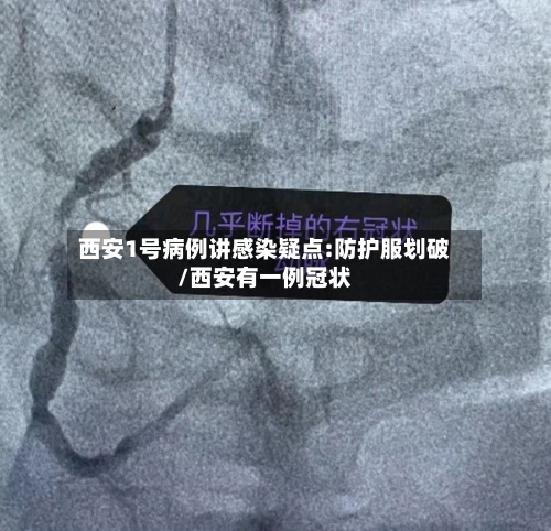 西安1号病例讲感染疑点:防护服划破/西安有一例冠状-第2张图片