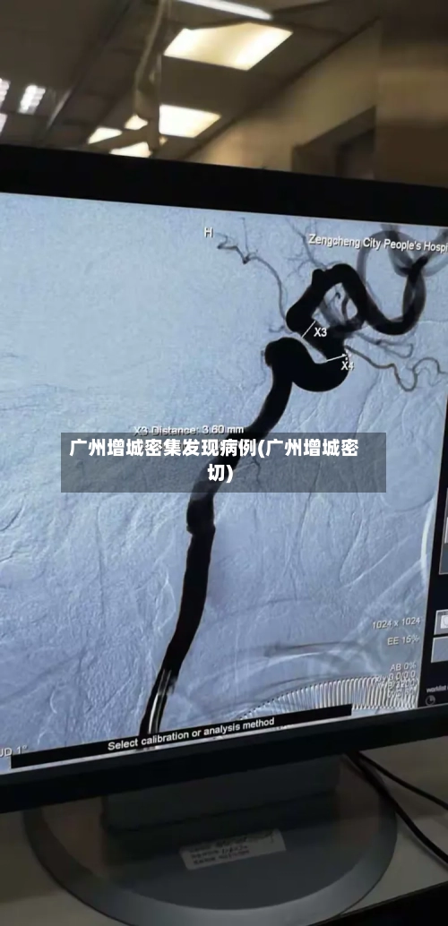 广州增城密集发现病例(广州增城密切)