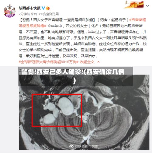 警惕!西安已多人确诊!(西安确诊几例)-第3张图片